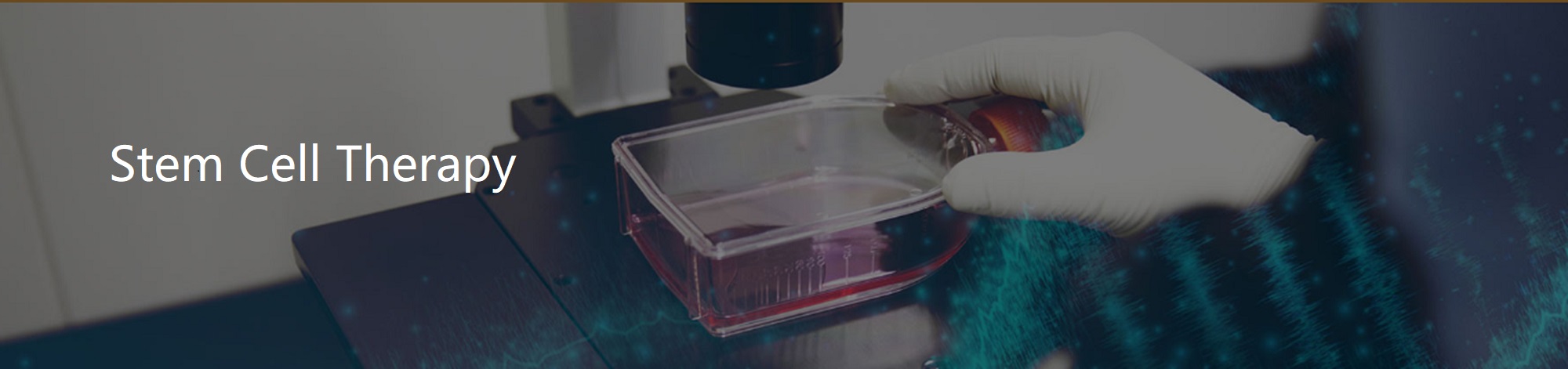 Stem Cell Therapy